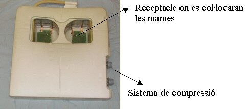 Imatge de la llitera d'exploració de la Ressonància Magnàtica de Mama