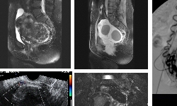 Imatge per la Unitat de Radiologia Intervencionista ( UDIAt - PArc TAuli)