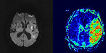 Enllaç al web de la Unitat de Radiologia Vascular i Intervencionista (URVI)